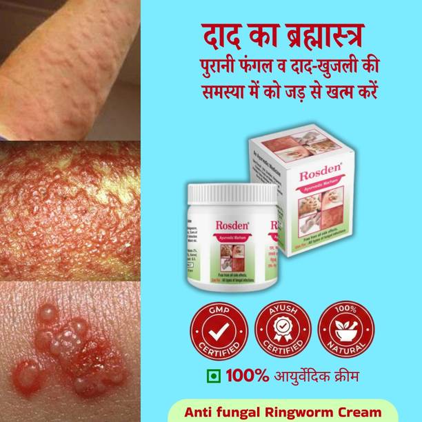 Rosden Antifungal Ayurvedic Cream 25g – Ringworm & Itching