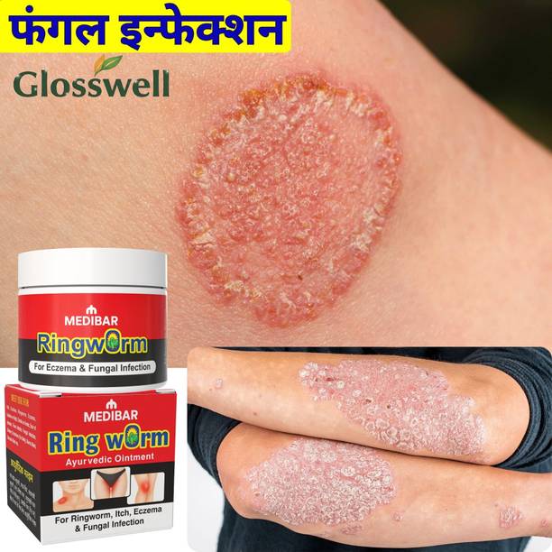 glosswell Ringworm Care Formula For Dry Itchy And Irritated Skin