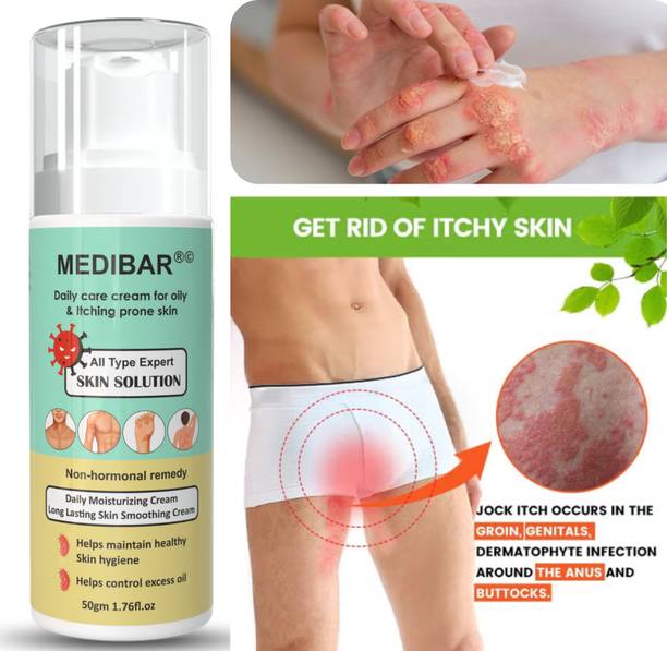 medibar Cream For AntiFungal, Itching, Ringworm, Antibacterial Skin Treatment
