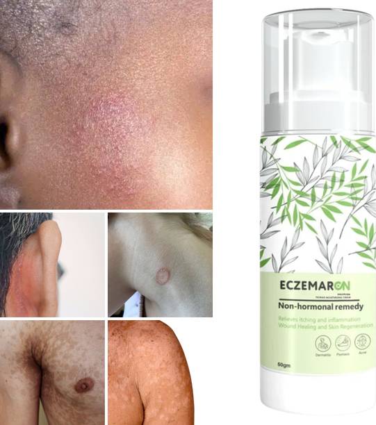 Eczemaron Ringworm Antifungal Spray