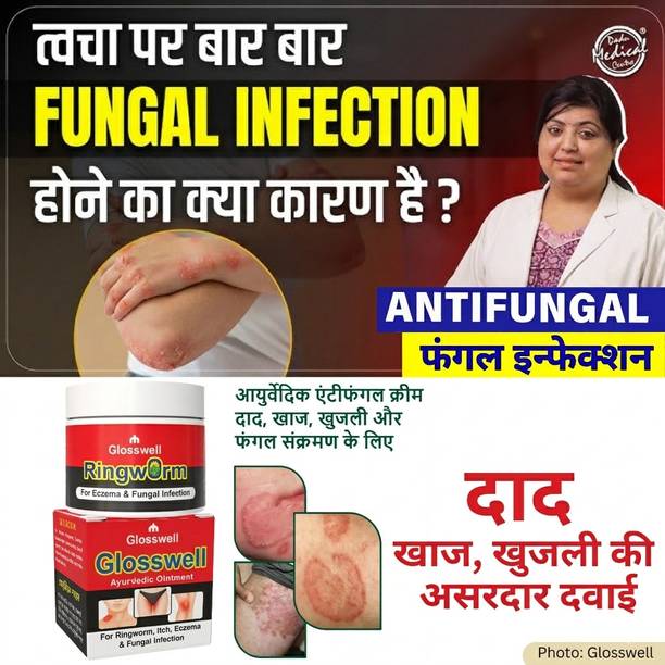 glosswell Ayurvedic Ringworm Treatment Cream for Skin Itching and Fungal Infection Care