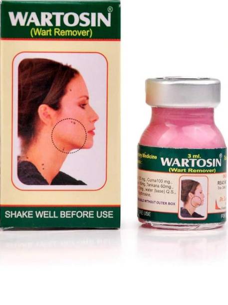 Wartosin Ayurvedic Wart Remover-|Massa Remover