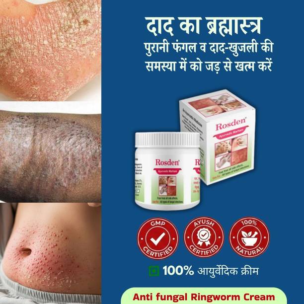 Rosden Daad Khaj Cream 25g – Natural Ayurvedic Antifungal