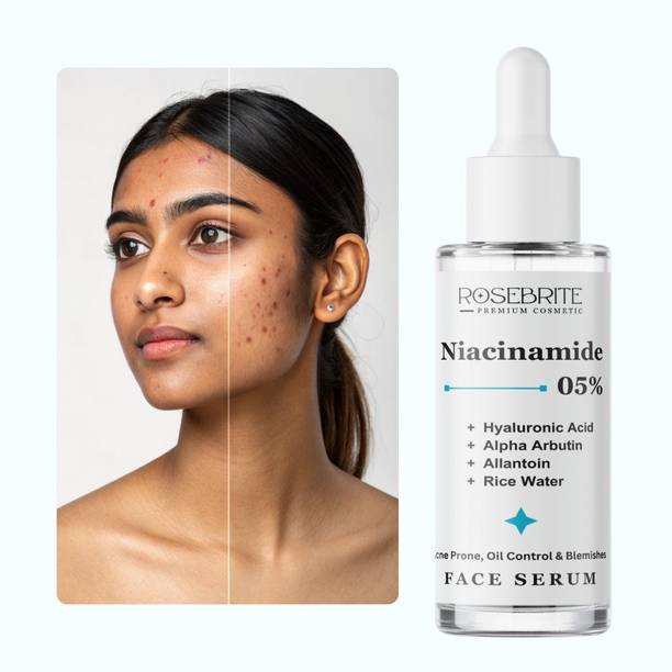 RoseBrite Niacinamide Hyaluronic Acid Alpha Arbutin Serum for Glowing Skin, Pigmentation Reduction, Brightening & Smooth Texture