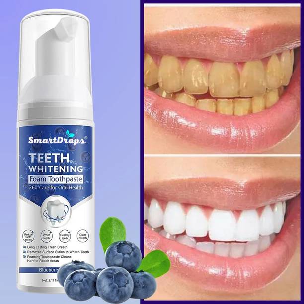 smartdrops GlowFoam Dentashine: Brilliance for Your Brightest Smile Teeth Whitening Kit