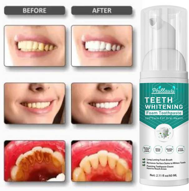 Phillauri Teeth Whitening Foam To Removes Bad Breath and Fights Germs Teeth Whitening liquid