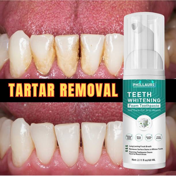 फिल्लौरी Teeth Whitening Foam To Deeply Cleaning Gums, Stain Removal Teeth Liquid टीथ व्हाइटनिंग लिक्विड