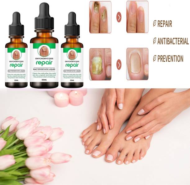 MILAN Enterprise Nail Serum for Nail Growth & Repair, Fungal Infection, Anti-infective (90 ml) Men & Women