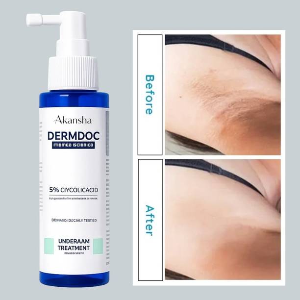 AKANSHA 5% Glycolic Acid & 2% Salicylic Acid Body Acne Spray Men & Women