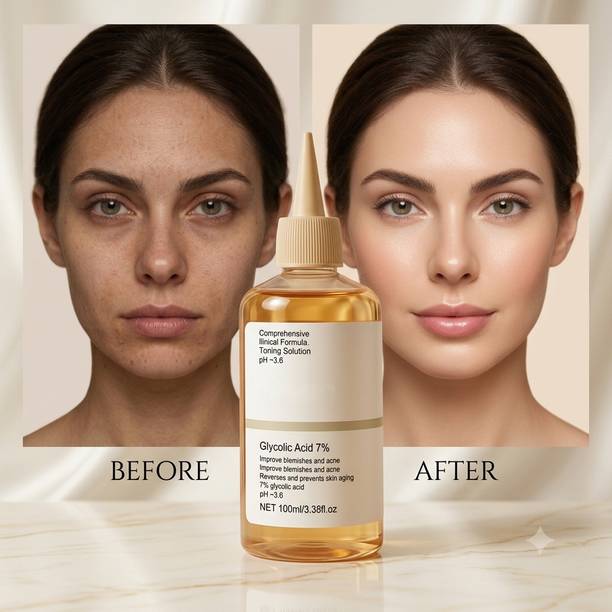 TOOVUS Glycolic Acid 7% Toner for Pigmentation & Skin Brightening Men & Women