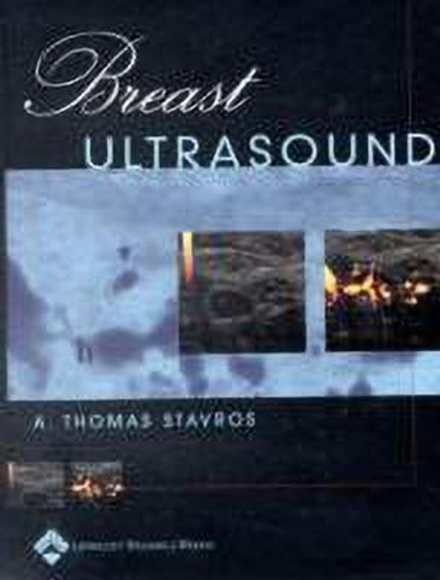 健康・医学 Breast Ultrasound A. Thomas Stavros Breast Ultrasound: 9780397516247: Medicine & Health Science