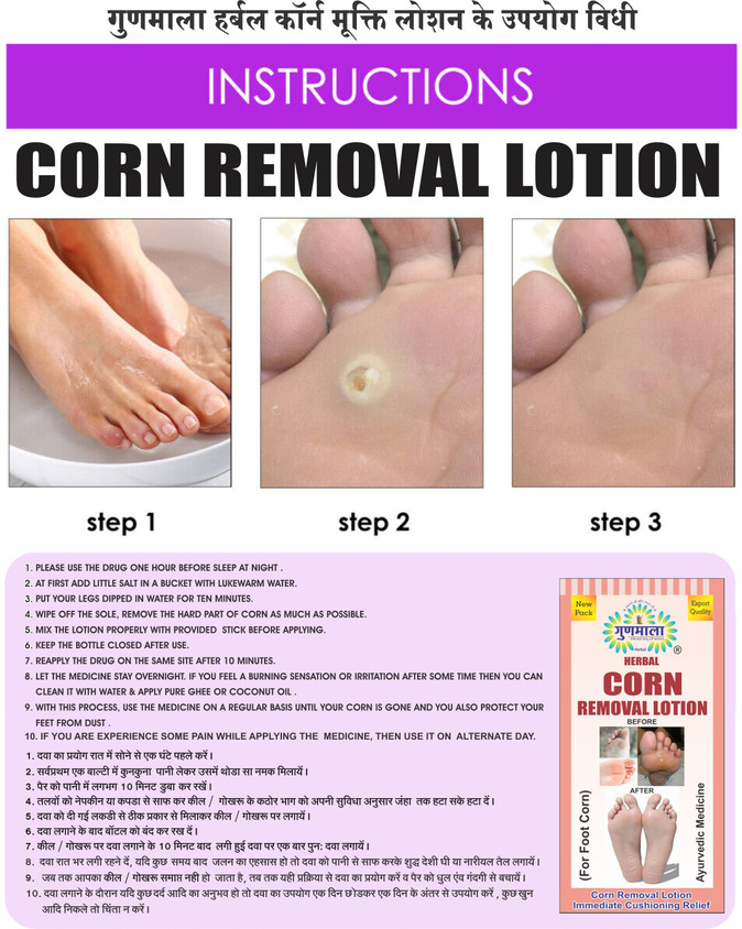 Little Toe Corns On Your Feet Big Toe Callus Remove Corns And