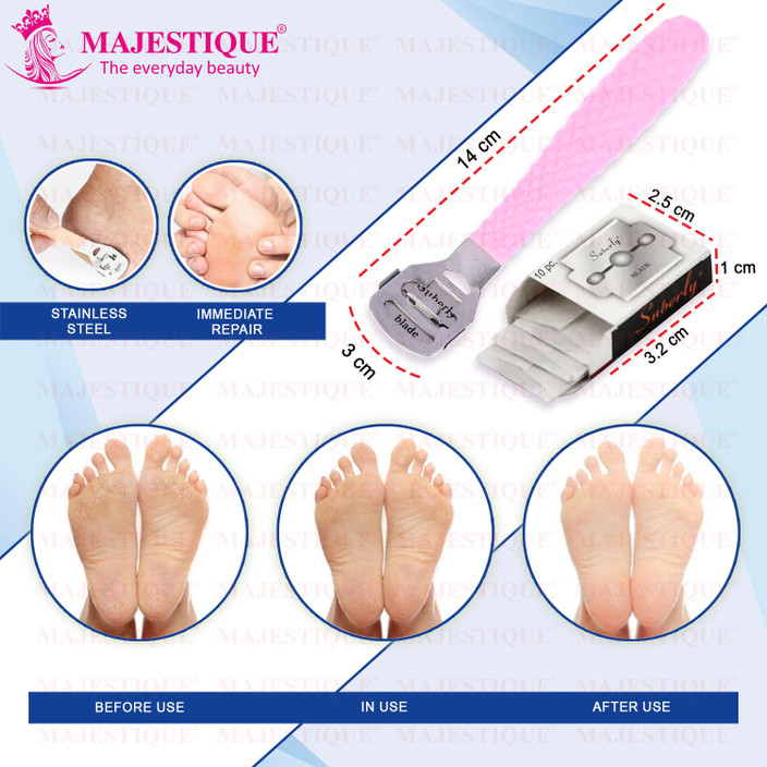 MAJESTIQUE Corn Cutter for Foot, Hard Skin Callus Remover for