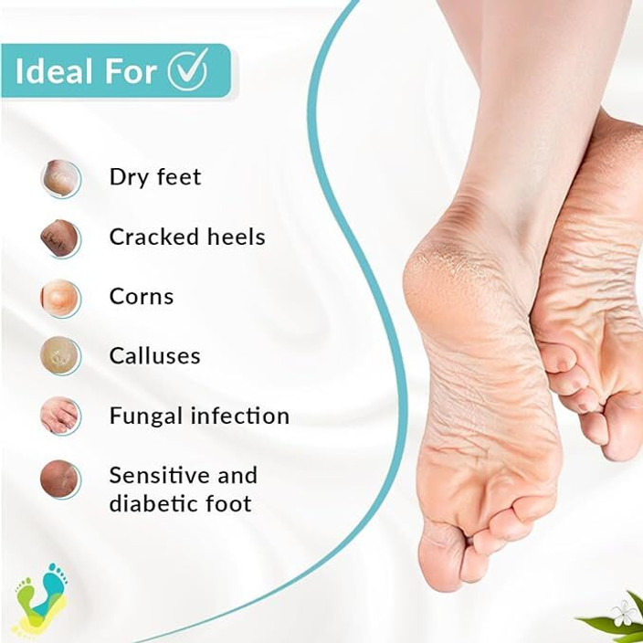 Fungal Infection Dry Cracked Bleeding Heels My Feet Are Dry And