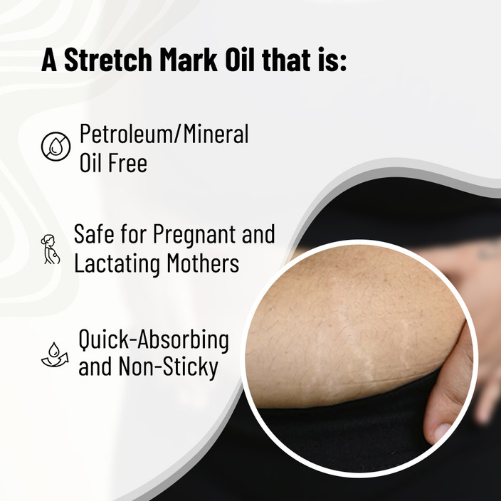 Chemist at Play Stretch Mark & Scar Fading Oil For Women