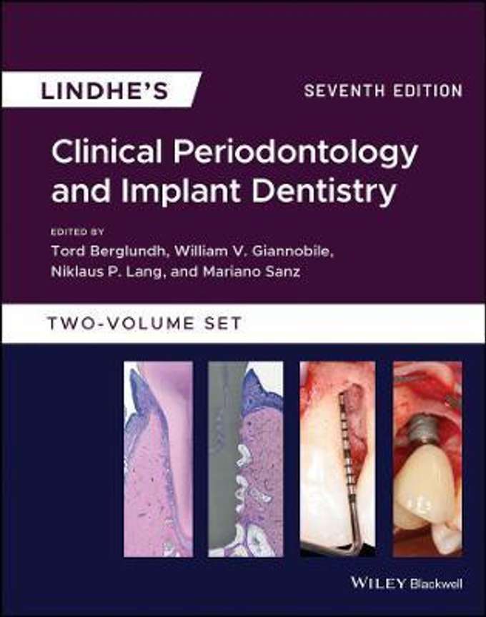 Lindhe's Clinical Periodontology and Implant Dentistry, 2 Volume Set: Buy Lindhe's Clinical Periodontology and Implant Dentistry, 2 Volume Set by unknown at Low Price in India | Flipkart.com Lindhe's Clinical Periodontology and Implant Dentistry, 2 Volume Set: Buy Lindhe's Clinical Periodontology and Implant Dentistry, 2 Volume Set by unknown at Low Price in India | Flipkart.com
