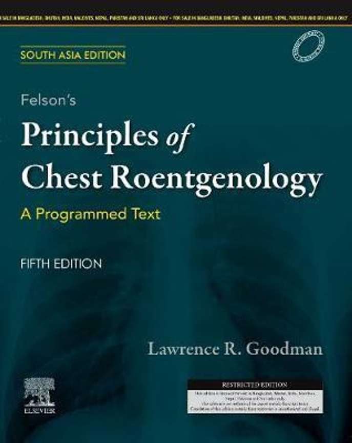 FELSON'S PRINCIPLES OF CHEST ROENTGENOLOGY: A PROGRAMMED TEXT, 5E-SOUTH ASIA EDITION FELSON'S PRINCIPLES OF CHEST ROENTGENOLOGY: A PROGRAMMED TEXT, 5E-SOUTH ASIA EDITION