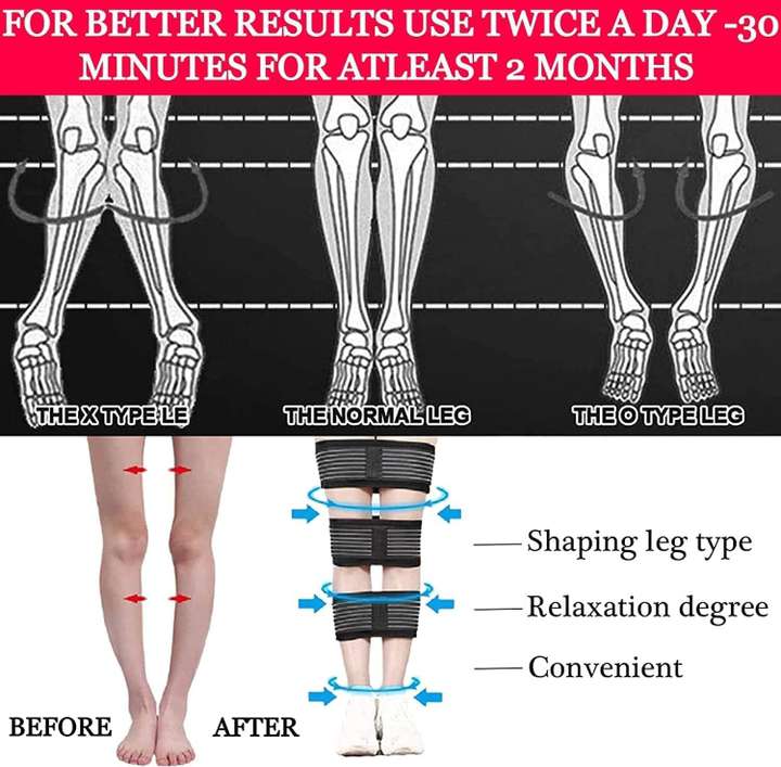 bow leg correction belt for men women leg posture corrector o x belt support NA Buy bow leg correction belt for men women leg posture corrector o x belt support NA