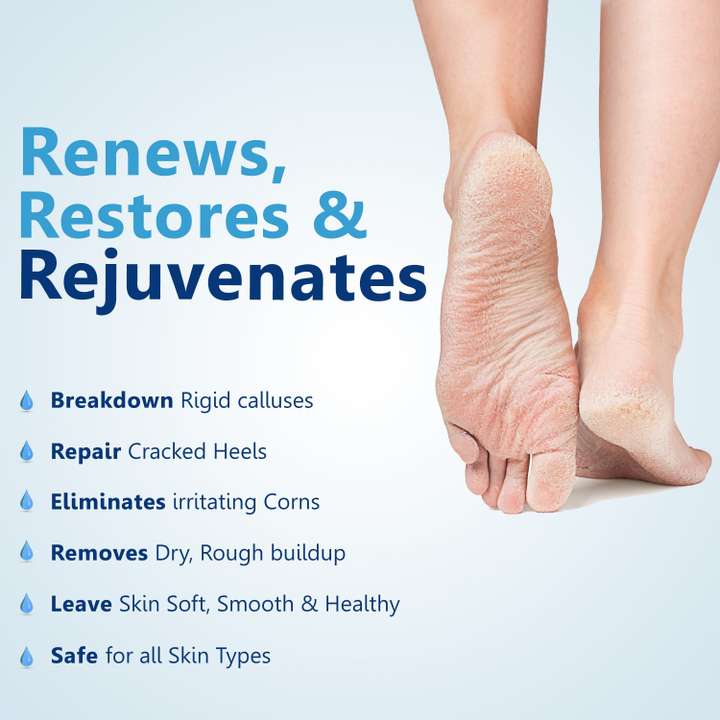 Removing callus from heel clearance
