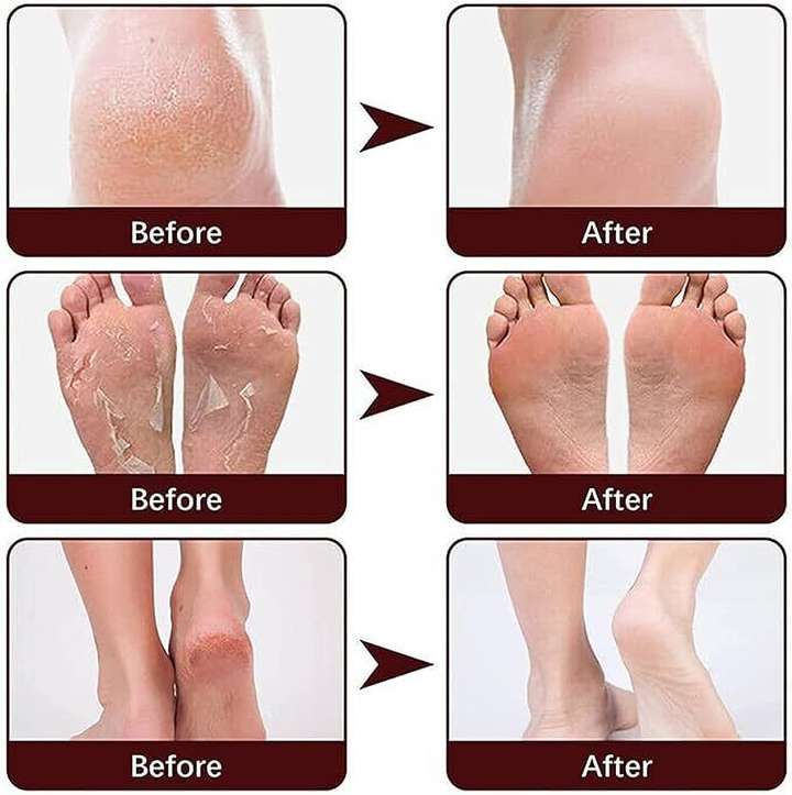 GoReady Foot Repair Cream for Foot Fungus Dry Cracked Feet and Smelly Feet Price in India Buy GoReady Foot Repair Cream for Foot Fungus Dry Cracked Feet and Smelly Feet online