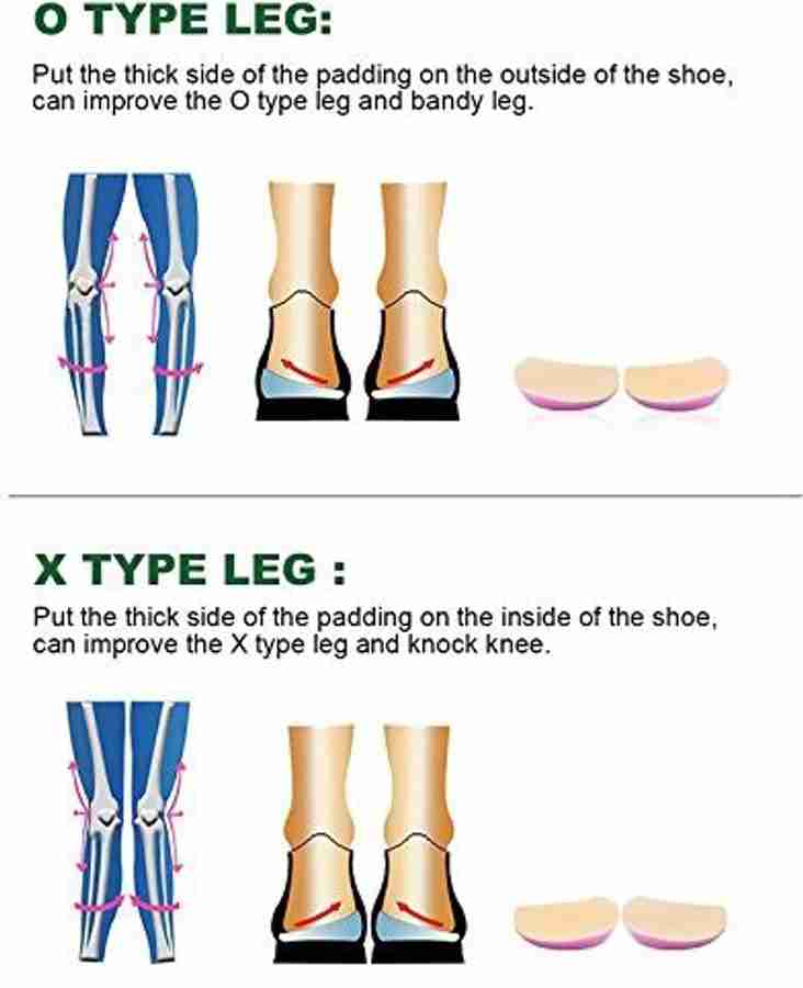 Insoles for clearance bow legs