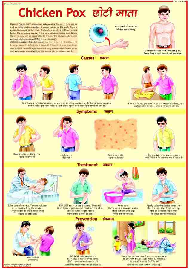 Chicken Pox Symptoms Chart