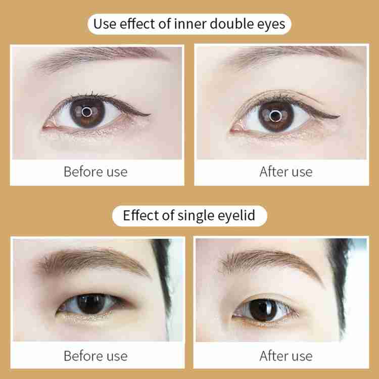 Eyelid sticker 2025 tape