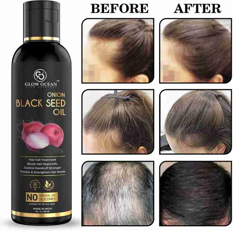glowocean Onion Black Seed oil For Hair Fall Control Hair Growth