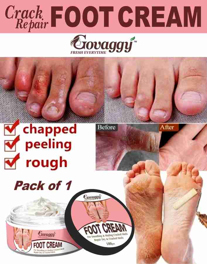 Govaggy Foot Crack Cream Price in India Buy Govaggy Foot Crack