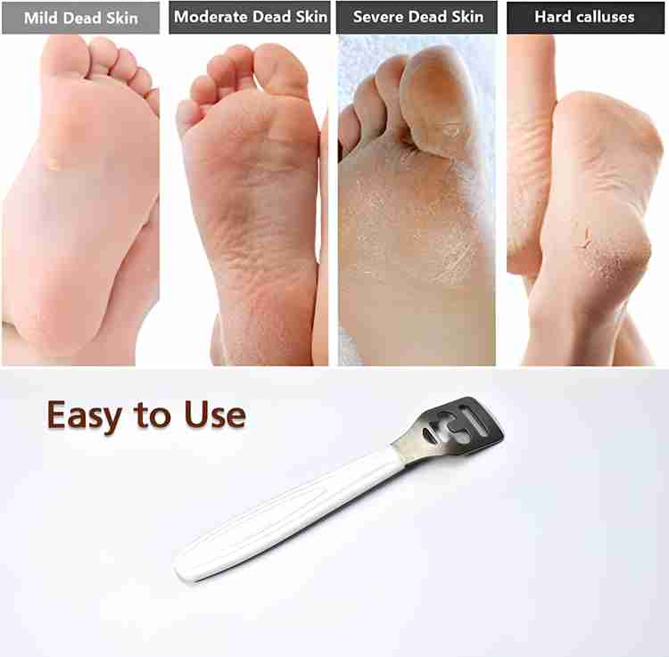 Warrior Callus Corn Hard Skin Remover Plastic Handle Foot Rasp Heel File Scrubber Price in India Buy Warrior Callus Corn Hard Skin Remover Plastic Handle Foot Rasp Heel File Scrubber Online