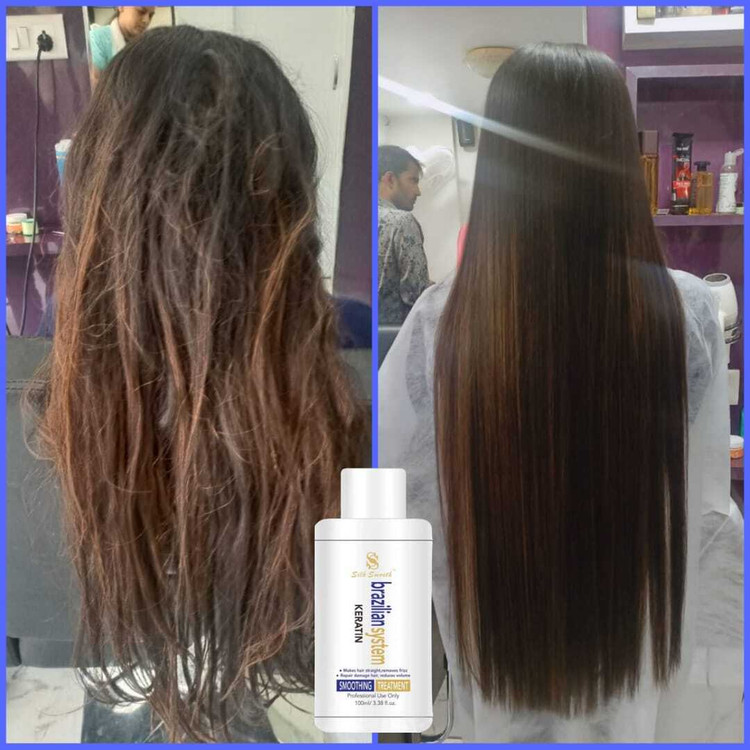 brazilian treatment cost