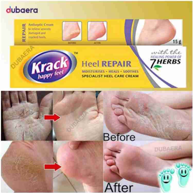 Krack in foot online