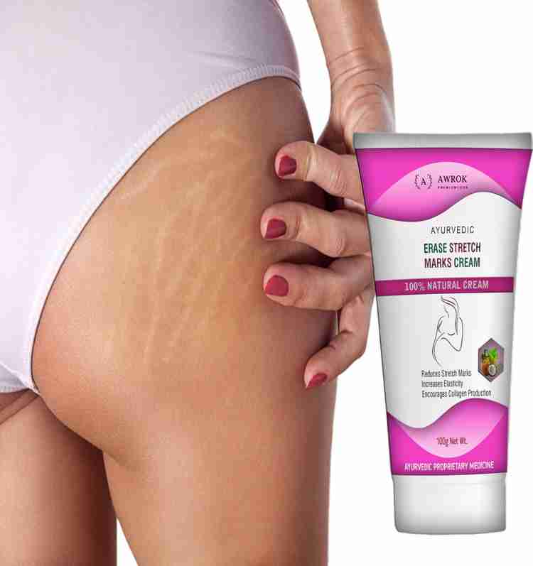 Stretch mark deals cream for men