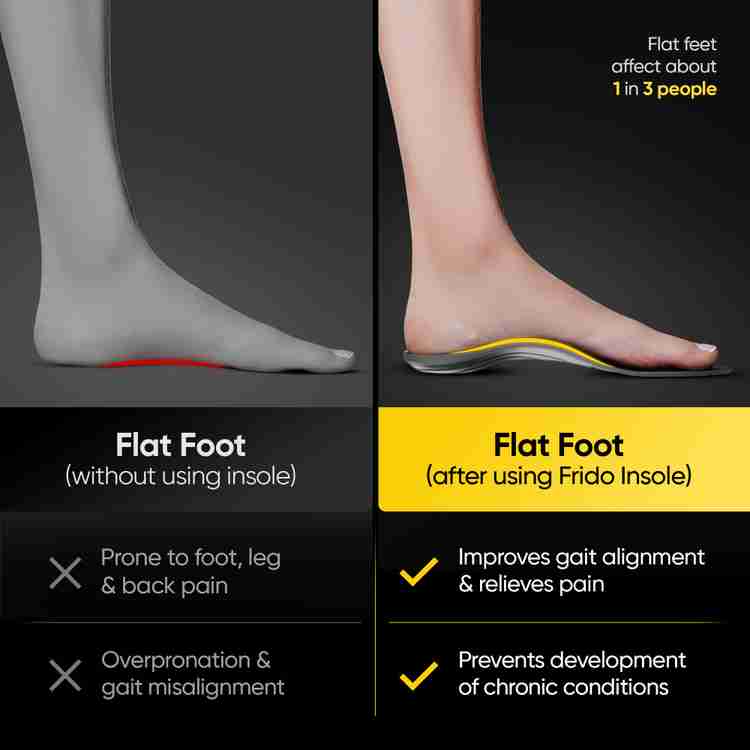 Rigid flat feet store
