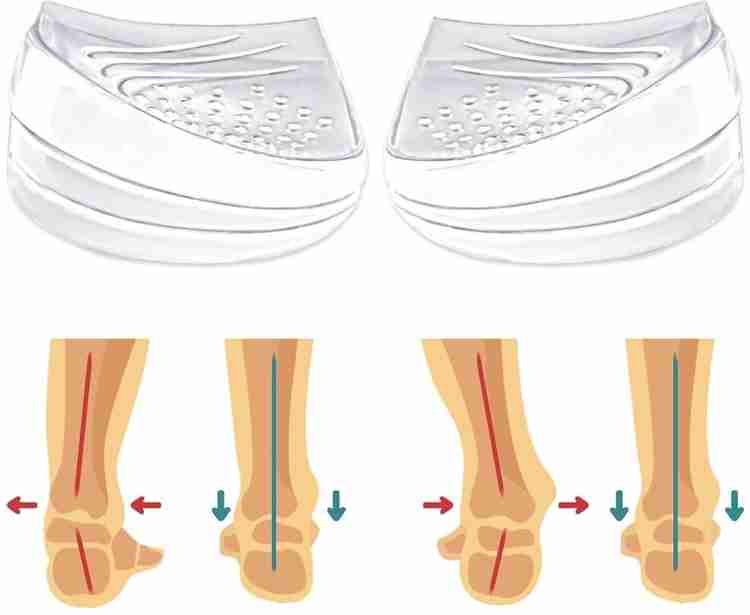PALAY Adjustable Orthotics Shoe Insert Heel Wedge for Supination Pronation Foot Support Buy PALAY Adjustable Orthotics Shoe Insert Heel Wedge for Supination Pronation Foot Support Online at Best Price...