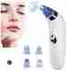 FURESTA Blackhead Remover Vacuum Suction Device - Image 7
