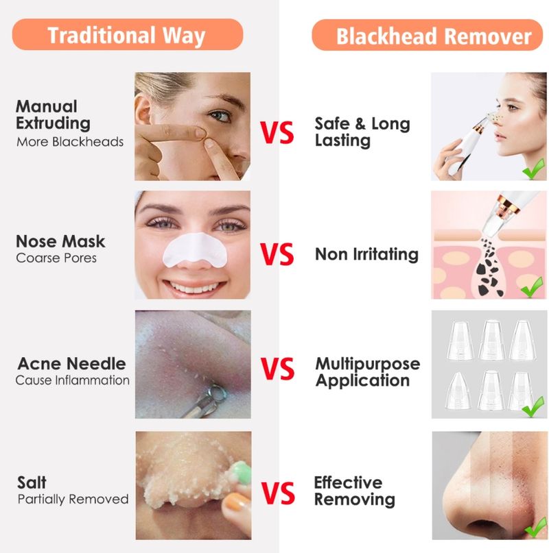 FURESTA Blackhead Remover Vacuum Suction Device - Image 5