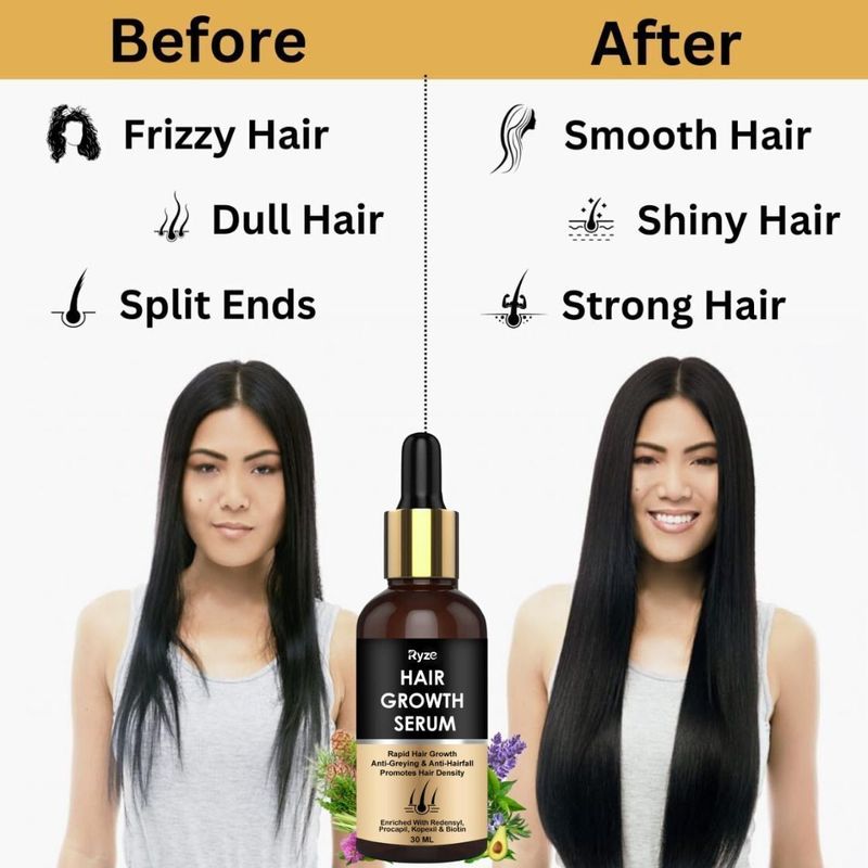Ryze Advanced Serum for Hair Growth - Image 6