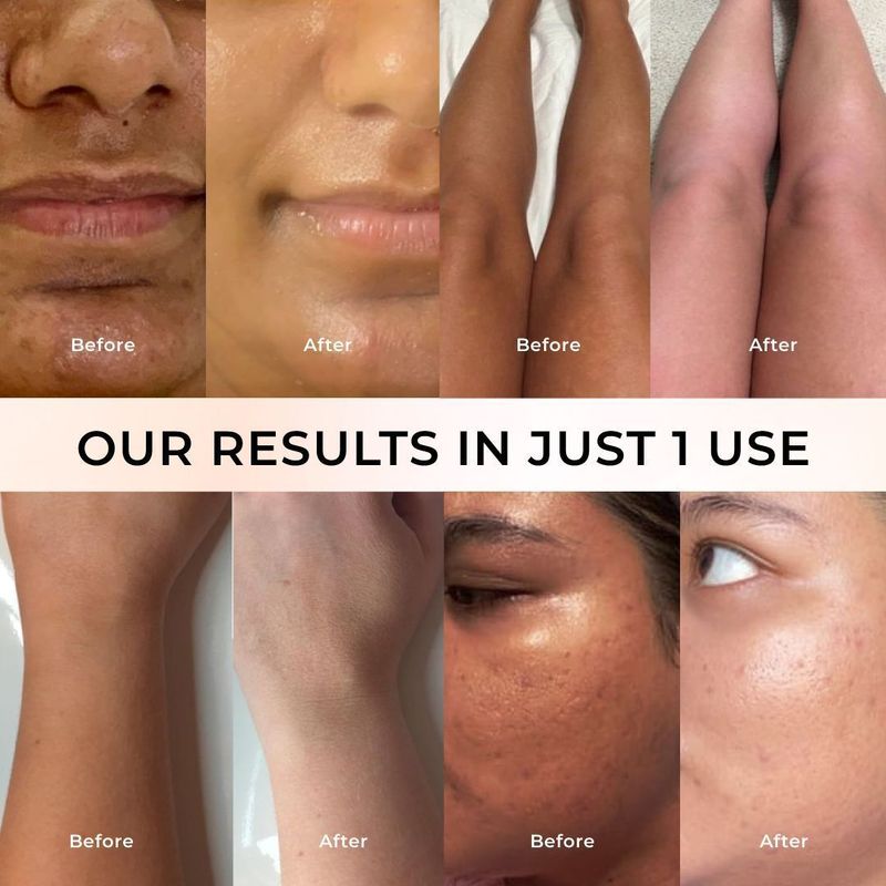 Niconi Gluta-Kojic Instant Tan Removal - Image 6