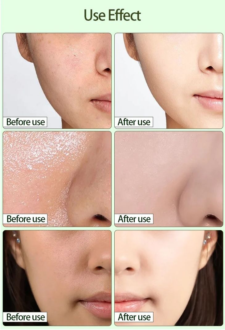 GABBU Blackhead Remover Face Stick 40g Green - Image 5