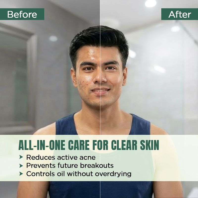 THE MAN COMPANY Anti-Acne Facewash 100ml - Image 5