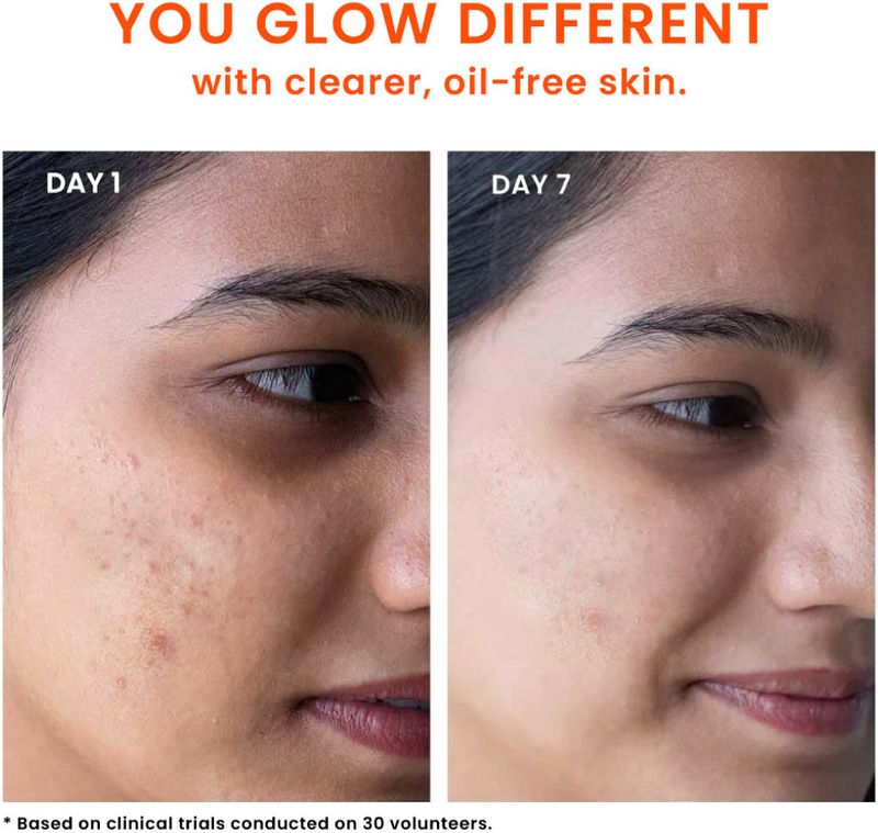 Foxtale Anti-Acne Face Wash with 2% Salicylic Acid, Niacinamide & - Image 6