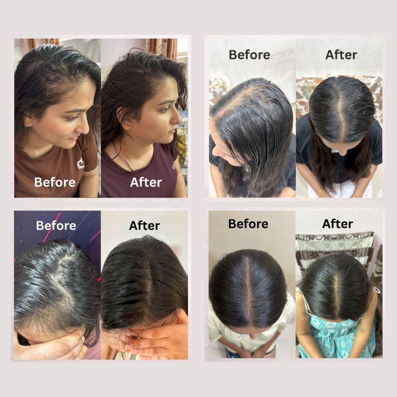 SAYY Scalp Revival Hair Serum - Image 6