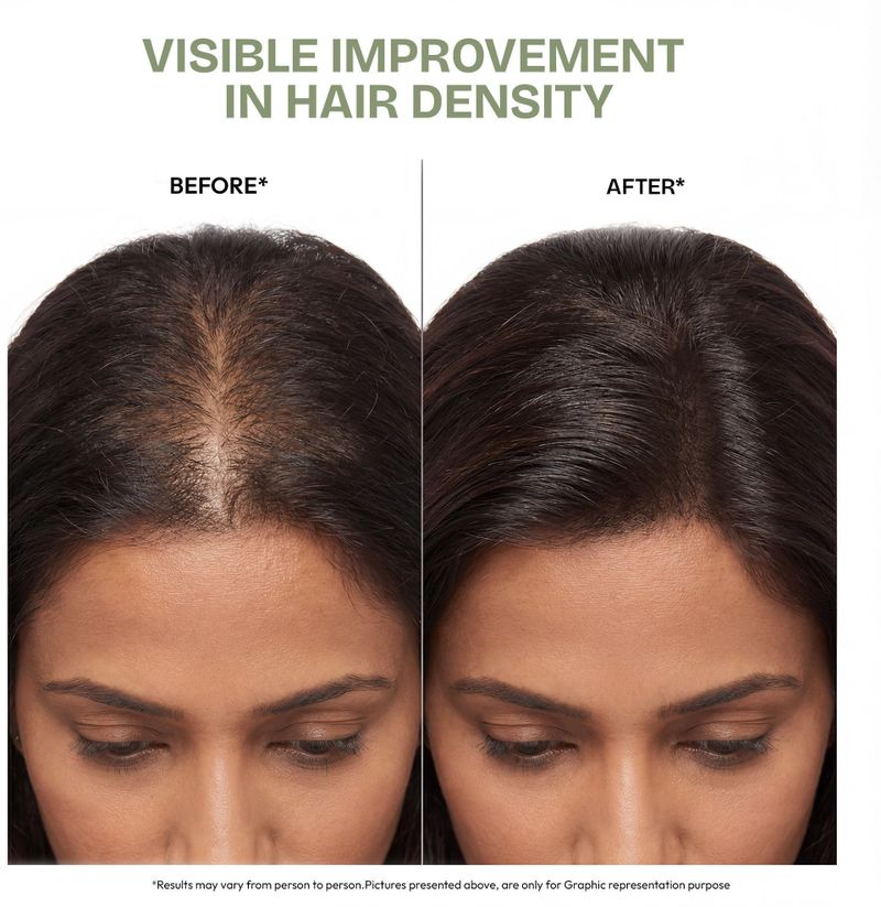 Proskire Ultimate Hair Growth Oil 100ml - Image 4