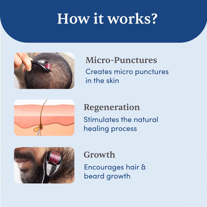 Man Matters Derma Roller for Hair Growth 0.5mm - Image 5