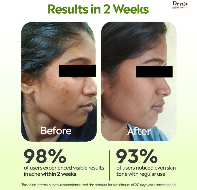 Deyga Aloe Vera Gel 100% Pure Multipurpose - Image 3