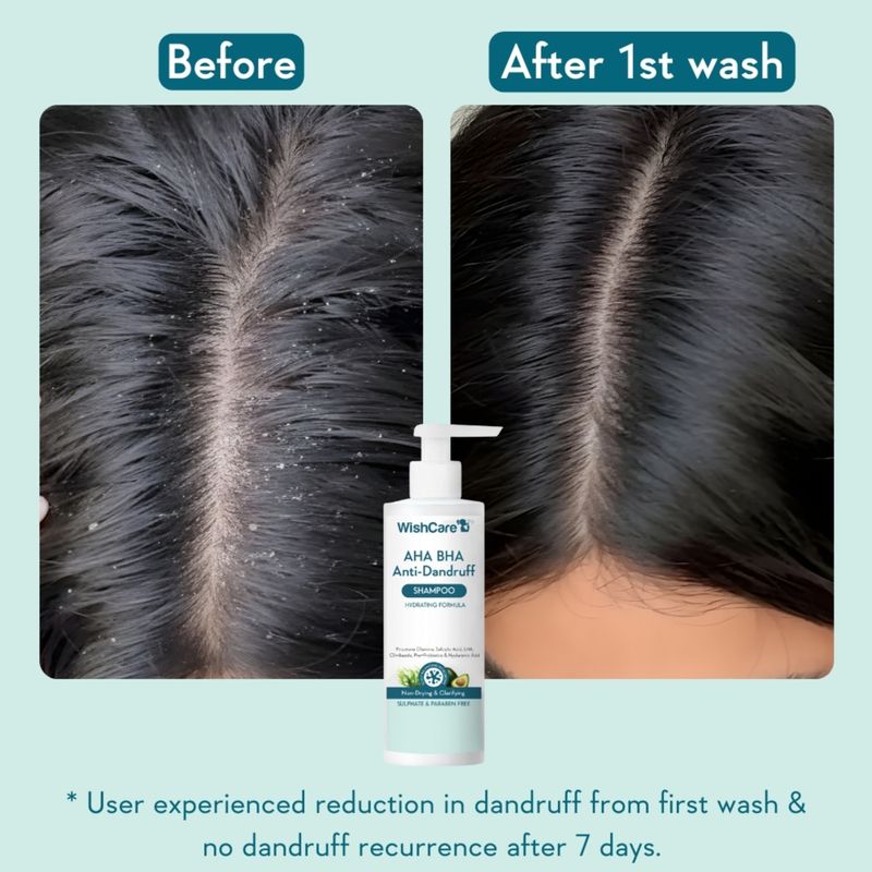 WishCare Hydrating AHA BHA Anti Dandruff Shampoo 100% Dandruff - Image 3