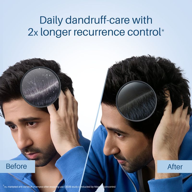 Scalpe Pro Anti dandruff Shampoo (200 ml) - Image 4
