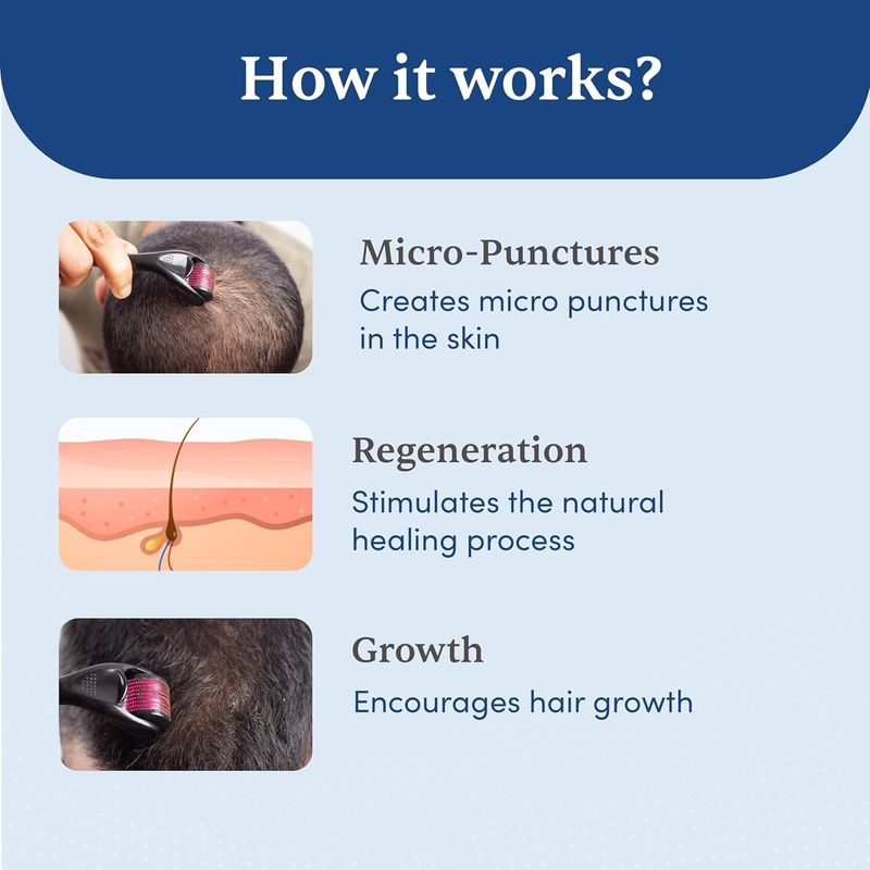 UNVELIS Derma Roller 540 Needles Hair Growth - Image 6