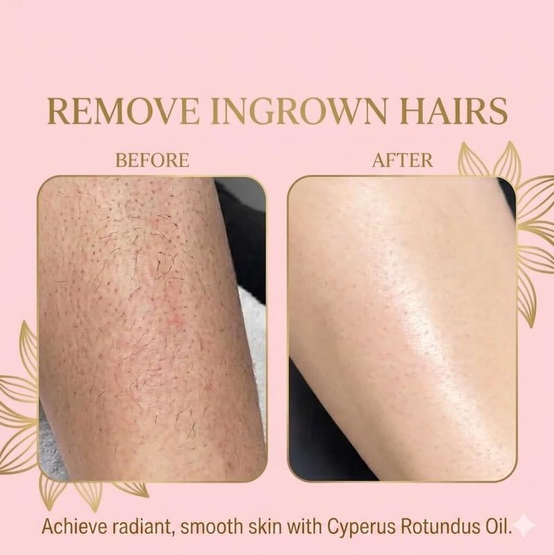 SCRILLS Cyperus Rotundus Smooth Skin Oil - Image 6